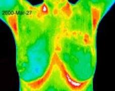 FLIR Interpretation of Thermography