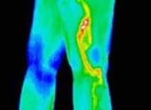 FLIR Interpretation of Thermography