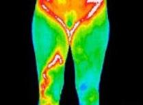 FLIR Interpretation of Thermography
