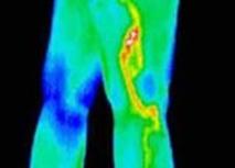 Thermography in Medicine Colour Map 9