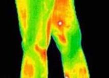 Thermography in Medicine Colour Map 8