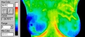 Thermography in Medicine Colour Map 6